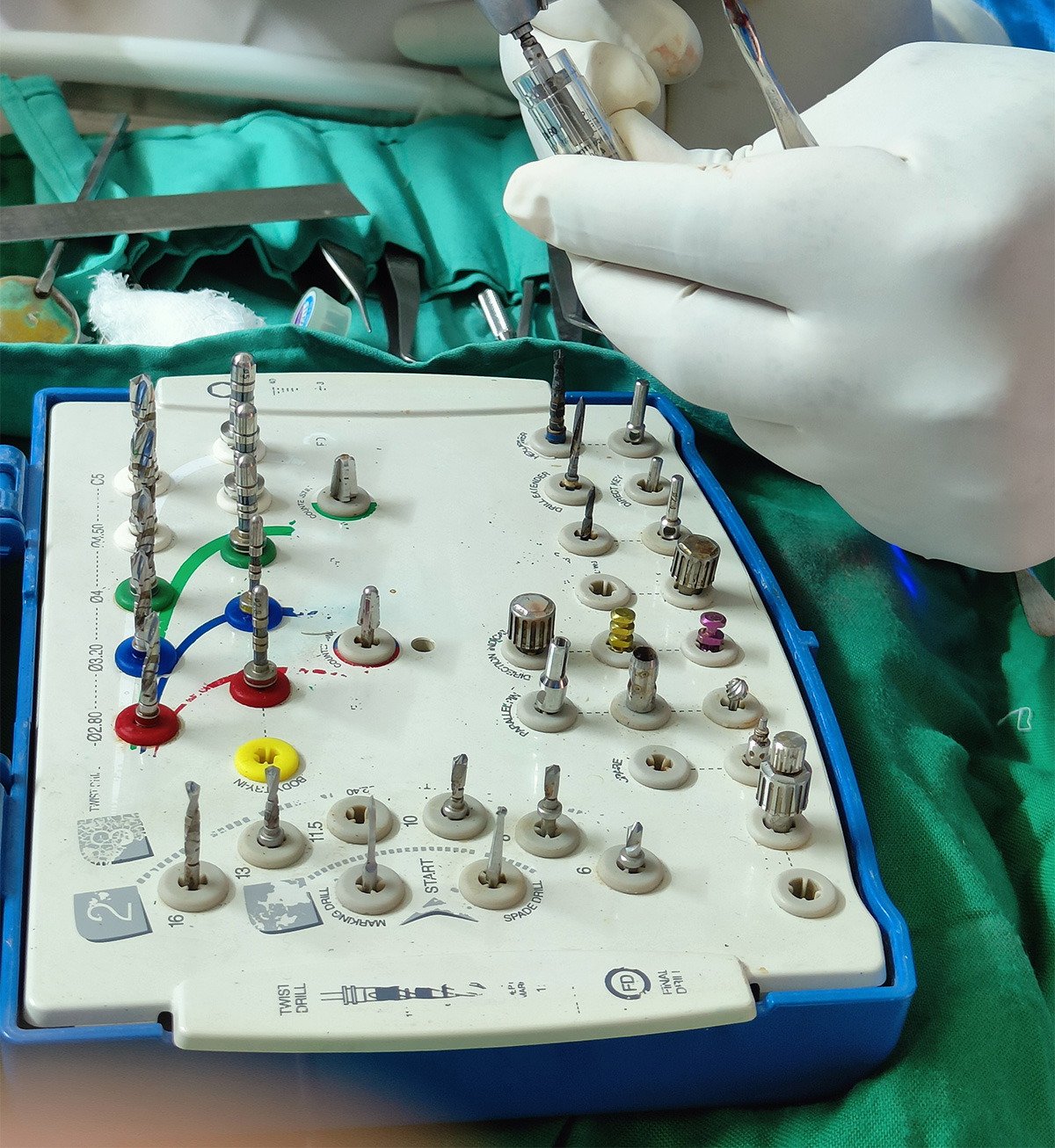 Digital Implantology